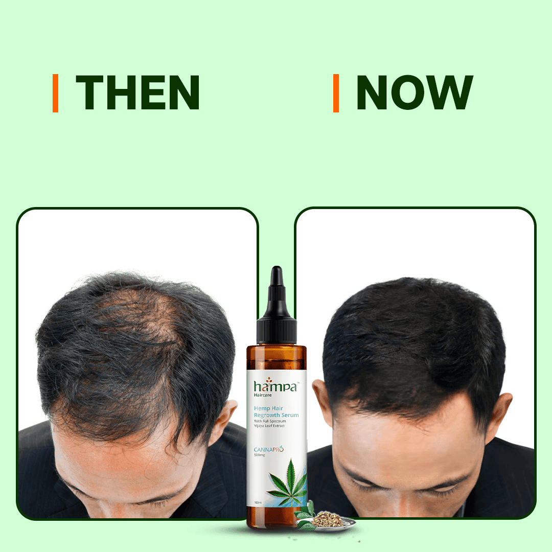 
                  
                    Hampa Hair Regrowth Serum 100ml + Free Hair Shampoo 200 ml
                  
                